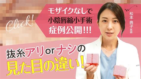 小陰唇縮小術（びらびらの切除）｜婦人科形成なら湘南美容クリ 